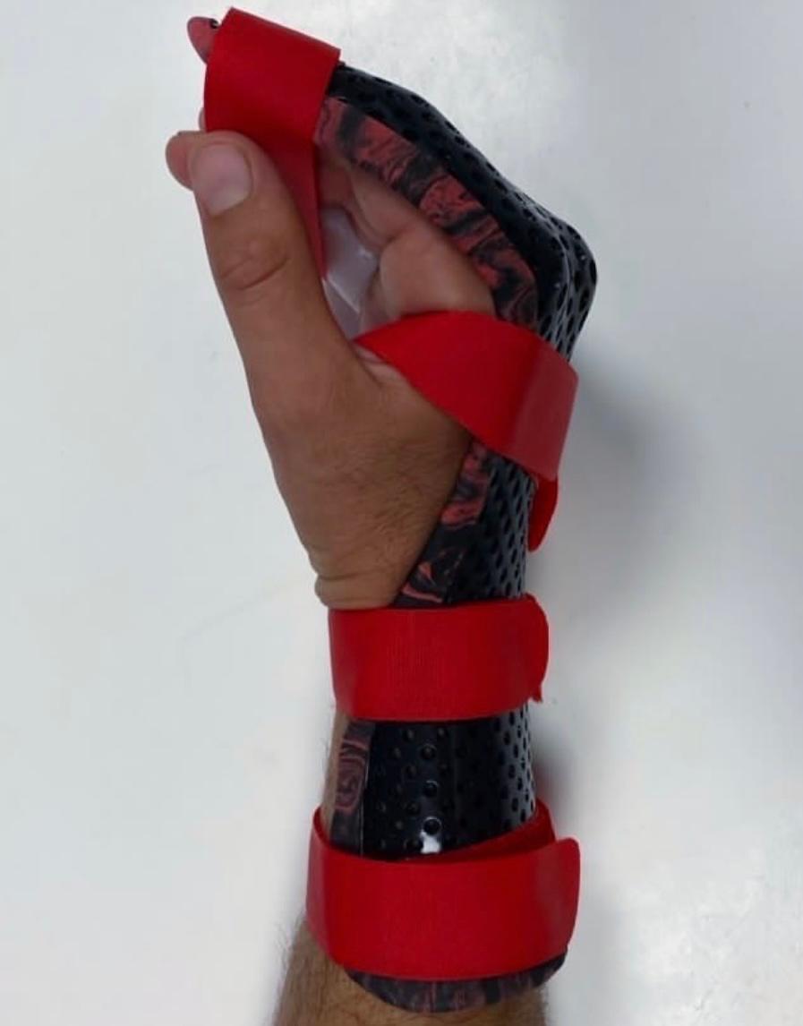 Image de Orthèses